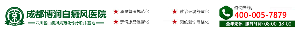 成都白癜风医院